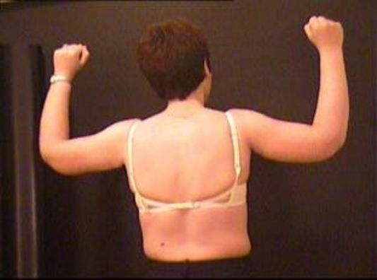 KARDIAN μπράτσα μετά