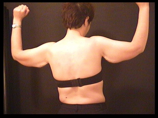 KARDIAN μπράτσα πριν